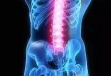 腰間盤突出，試試三七！90%人還不知道！-酷播亮新聞