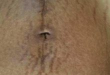 生完寶寶后孕媽身體上4處痕迹，瞬間就出賣了她已育的身份-酷播亮新聞