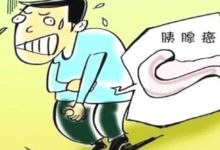 為什麼胰腺癌早期不容易發現？-酷播亮新聞