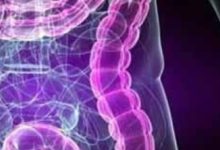 前列腺由什麼引起的-酷播亮新聞