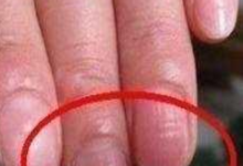 肝病「來臨」的三大徵兆，你有沒有？-酷播亮新聞