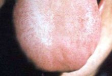 男人腎不好，一看舌頭二看手，這4點養腎常識最為關鍵！-酷播亮新聞