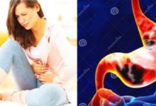 多年的胃病為什麼總是治不好？-酷播亮新聞