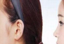 醜女出國整容，回國后嫁給富豪，不料被發現真相告上法庭-酷播亮新聞