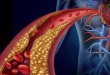 這兩個高血脂容易忽視的誤區不能忽視要了解-酷播亮新聞