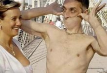 世界上皮膚最有彈性的人-酷播亮新聞