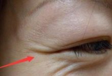 35歲小姑用開塞露做成「不老液」睡眠一抹三周去除斑點減少皺紋-酷播亮新聞