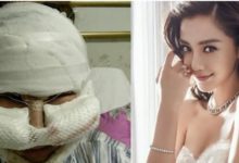 她，為了讓自己變成楊穎，去做了整容，結果真的是太尷尬了！-酷播亮新聞