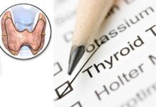 有一種疾病叫亞臨床甲減！到底什麼是亞臨床甲減？-酷播亮新聞