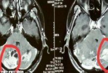 女子患上精神障礙，家屬卻偏偏將其送進腫瘤科！為何？-酷播亮新聞