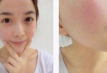 春天來了，換季時皮膚最脆弱如何保護皮膚呢？你肯定想不到-酷播亮新聞