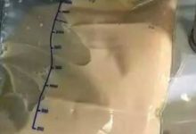 三餐靠外賣，血漿竟變成「豬油色」？-酷播亮新聞