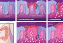 新發現：腸癌年輕化，是少了這兩種細菌的篩查-酷播亮新聞