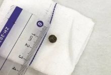 8歲男孩半年患肺炎四次，竟是因為孩子都愛吃的這東西！-酷播亮新聞