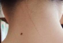 「此處」有痣的女人，婚姻生活最幸福，必定是旺夫旺財誰娶誰有福-酷播亮新聞