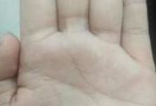 此處斷開的人，不論男女，千萬注意了，晚年必有大災大病-酷播亮新聞