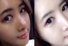 藥店2塊錢一瓶的小東西，堅持一月讓你色斑全消，皮膚柔嫩白皙-酷播亮新聞