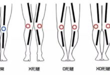 如何正確矯正腿型，變成完美腿型-酷播亮新聞
