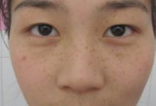 白醋加藥店不起眼的它，保濕又抗皺 ，大媽每天睡前來擦一擦-酷播亮新聞