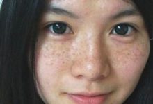 大姐祛斑不花一分錢，僅用廚房裡的它祛斑，半月重返20歲容顏-酷播亮新聞