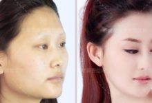 面部骨骼怎樣的比例是好看的-酷播亮新聞