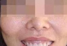 這種面相的女人，最是命苦，一輩子婚姻不順，還有克夫命！-酷播亮新聞