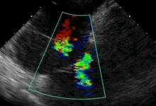 AI診斷心臟病比人類更準？但這只是識圖，不是診斷-酷播亮新聞
