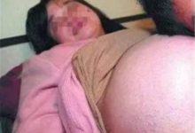 「已死」母親為肚中胎兒堅持兩天未斷氣-酷播亮新聞