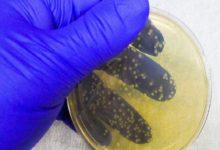 美國發現超級細菌歐洲人跟進，啥超菌忽悠人？百萬重病都視而不見-酷播亮新聞