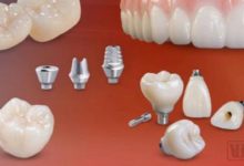 牙科行業正面臨技術和效率瓶頸，這家全球最大的義齒加工廠如何利用數字化突圍？-酷播亮新聞