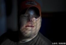 美國大兵在伊拉克戰爭中毀容，女友堅持結婚-酷播亮新聞