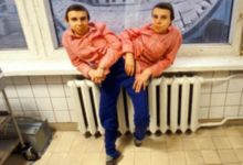 世界最老連體姐妹揭秘-酷播亮新聞