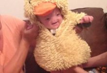 女子生下怪異「外星寶寶」！整張臉竟沒有鼻子-酷播亮新聞