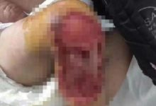 男嬰被綁家中疑遭老鼠啃咬 父母失聯數月-酷播亮新聞