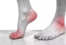 避開7種食物，尿酸「蹭蹭」往下降！-酷播亮新聞