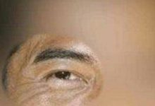 魚尾紋太多太亂者，主其人勞碌終身，同時刑妻尅子，奸詐好色-酷播亮新聞