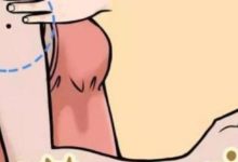 「此處」有痣的人，命有橫財一筆，註定一生高不可攀-酷播亮新聞