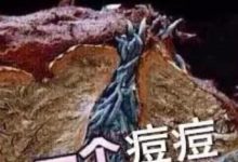 別以為只是痘痘，那是滿臉的蟲在爬！-酷播亮新聞