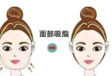 V顏教你如何選擇「變」美的方法-酷播亮新聞