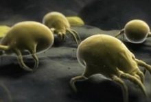 毛孔擠出白色線狀物，是蟎蟲！2招清理蟎蟲垃圾-酷播亮新聞