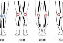 腿型丑，真的只是遺傳嗎？-酷播亮新聞