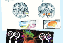 臉盲症是因為記性太差？-酷播亮新聞