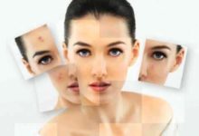 導致黃褐斑的因素(滄州中科醫院看皮膚病口碑怎麼樣)-酷播亮新聞