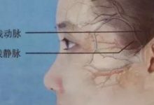 面部填充有什麼風險？失敗了該怎麼辦？-酷播亮新聞