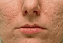 用錯洗面奶會「未老先衰」嗎? 為什麼身邊有人不用洗面奶?-酷播亮新聞