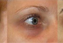 悅姐保養攻略，女性如何緩解眼部衰老？這一點很重要-酷播亮新聞