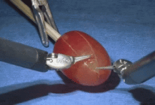 為了改善暴躁，他們想到了割人腦-酷播亮新聞