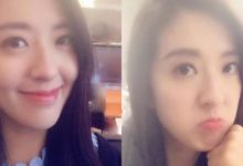 用xx按摩急救眼腫臉腫 超有效家中消除水腫小道具-酷播亮新聞