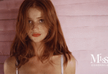 祛斑得分類型，有些真祛不掉，網友：雀斑女人更可愛時髦-酷播亮新聞