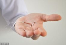 上環對子宮的傷害，原來分為4個等級，可不要等到第3級才去拆-酷播亮新聞